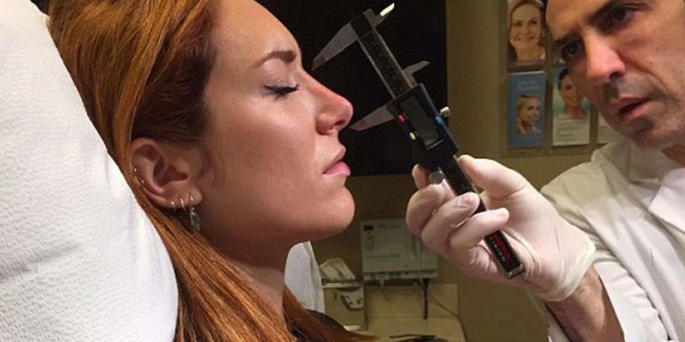 Clip tiêm Filler vào mũi sau đó bóp nặn thành dáng cao dài thẳng tắp đang được nhiều chị em chia sẻ vì... quá đáng sợ - Ảnh 7. Clip tiêm Filler vào mũi sau đó bóp nặn thành dáng cao dài thẳng tắp đang được nhiều chị em chia sẻ vì... quá đáng sợ - Ảnh 7.