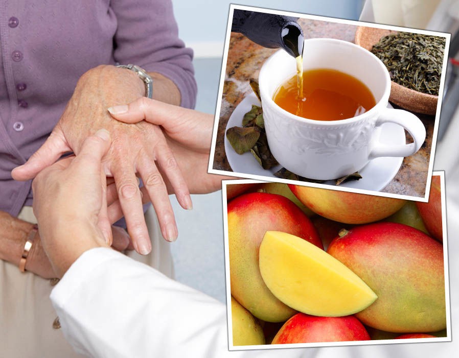 Hãy tạo cho mình những thói quen này hàng ngày để ngăn ngừa các triệu chứng đau khớp ở đầu gối, hông và bàn tay - Ảnh 2. Hãy tạo cho mình những thói quen này hàng ngày để ngăn ngừa các triệu chứng đau khớp ở đầu gối, hông và bàn tay - Ảnh 2.