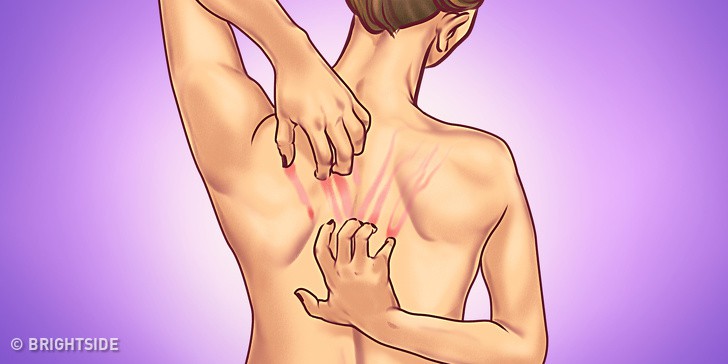 Một số thay đổi này của cơ thể có thể là dấu hiệu cảnh báo bệnh nên bạn đừng bao giờ bỏ qua - Ảnh 6. Một số thay đổi này của cơ thể có thể là dấu hiệu cảnh báo bệnh nên bạn đừng bao giờ bỏ qua - Ảnh 6.