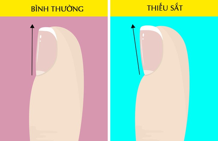 Hãy nhìn xuống đôi chân mình và xem nó đang cảnh báo bạn những vấn đề gì về sức khỏe - Ảnh 2. Hãy nhìn xuống đôi chân mình và xem nó đang cảnh báo bạn những vấn đề gì về sức khỏe - Ảnh 2.