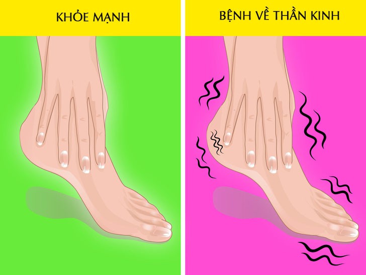 Hãy nhìn xuống đôi chân mình và xem nó đang cảnh báo bạn những vấn đề gì về sức khỏe - Ảnh 6. Hãy nhìn xuống đôi chân mình và xem nó đang cảnh báo bạn những vấn đề gì về sức khỏe - Ảnh 6.