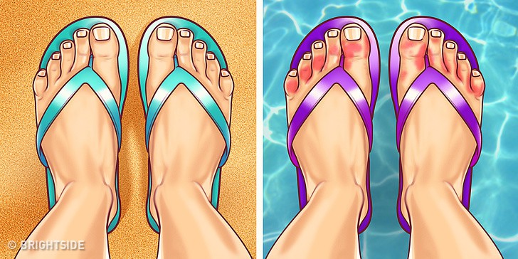 Thêm 5 dấu hiệu kì cục ở chân cảnh báo những rối loạn về sức khỏe không thể coi thường - Ảnh 3. Thêm 5 dấu hiệu kì cục ở chân cảnh báo những rối loạn về sức khỏe không thể coi thường - Ảnh 3.