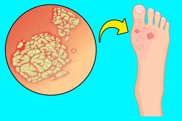 Thêm 5 dấu hiệu kì cục ở chân cảnh báo những rối loạn về sức khỏe không thể coi thường - Ảnh 1. Thêm 5 dấu hiệu kì cục ở chân cảnh báo những rối loạn về sức khỏe không thể coi thường - Ảnh 1.