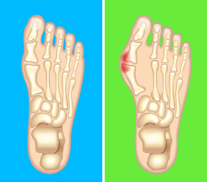 Nhìn ngay xuống bàn chân soi dấu hiệu bệnh tật cư trú trong người: Số 3 rất nguy hiểm! - Ảnh 7. Nhìn ngay xuống bàn chân soi dấu hiệu bệnh tật cư trú trong người: Số 3 rất nguy hiểm! - Ảnh 7.