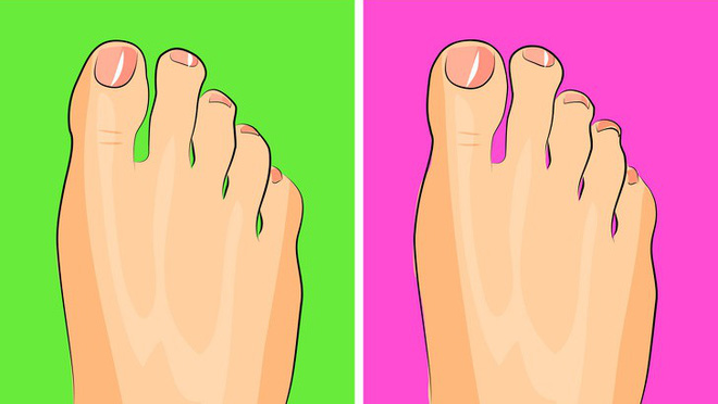 Nhìn ngay xuống bàn chân soi dấu hiệu bệnh tật cư trú trong người: Số 3 rất nguy hiểm! - Ảnh 8. Nhìn ngay xuống bàn chân soi dấu hiệu bệnh tật cư trú trong người: Số 3 rất nguy hiểm! - Ảnh 8.