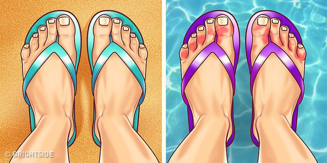 Nhìn ngay xuống bàn chân soi dấu hiệu bệnh tật cư trú trong người: Số 3 rất nguy hiểm! - Ảnh 9. Nhìn ngay xuống bàn chân soi dấu hiệu bệnh tật cư trú trong người: Số 3 rất nguy hiểm! - Ảnh 9.