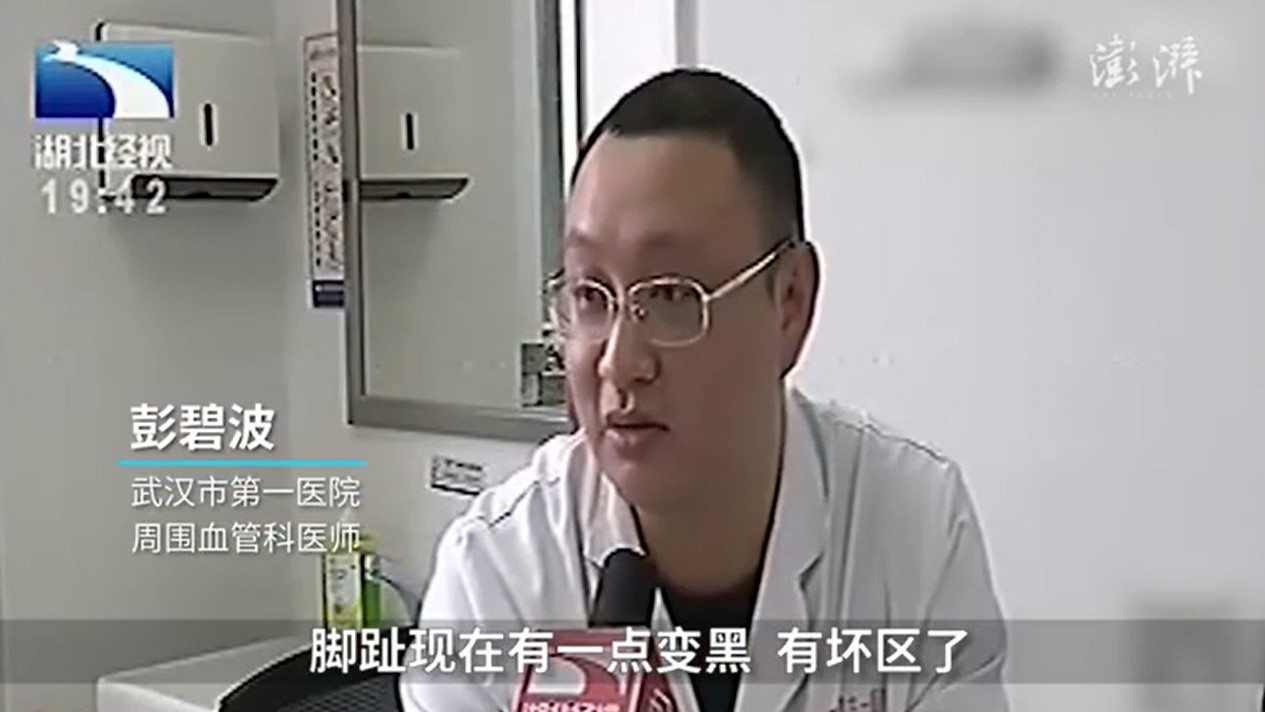 Con gái hiếu thảo thấy mẹ bị nấm liền mua thuốc khử trùng để ngâm chân, 3 ngày sau bà nhập viện vì suýt hoại tử - Ảnh 2. Con gái hiếu thảo thấy mẹ bị nấm liền mua thuốc khử trùng để ngâm chân, 3 ngày sau bà nhập viện vì suýt hoại tử - Ảnh 2.