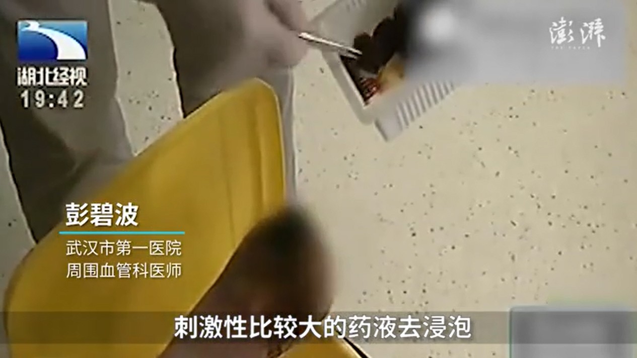 Con gái hiếu thảo thấy mẹ bị nấm liền mua thuốc khử trùng để ngâm chân, 3 ngày sau bà nhập viện vì suýt hoại tử - Ảnh 3. Con gái hiếu thảo thấy mẹ bị nấm liền mua thuốc khử trùng để ngâm chân, 3 ngày sau bà nhập viện vì suýt hoại tử - Ảnh 3.