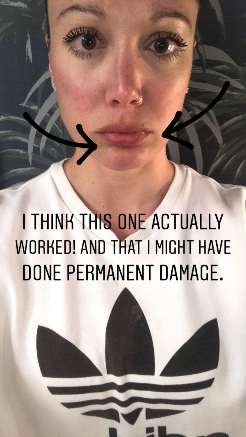 Kem đánh răng, ớt bột đến mù tạt… cô nàng đích thân thử nghiệm 5 cách “bơm” môi căng mọng tự nhiên để xem tác dụng thực hư - Ảnh 9. Kem đánh răng, ớt bột đến mù tạt… cô nàng đích thân thử nghiệm 5 cách “bơm” môi căng mọng tự nhiên để xem tác dụng thực hư - Ảnh 9.