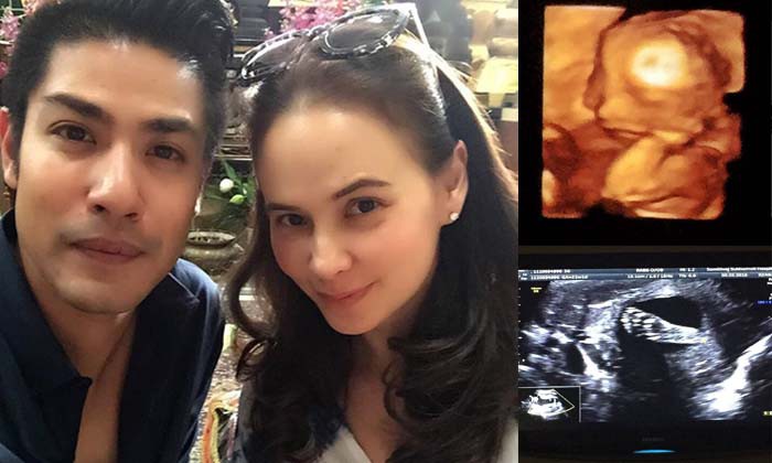 C&acirc;u n&oacute;i như tiếng s&eacute;t giữa trời d&ocirc;ng của mẹ chồng khiến người vợ trẻ ng&atilde; quỵ khi biết kết quả si&ecirc;u &acirc;m thai - Ảnh 2.