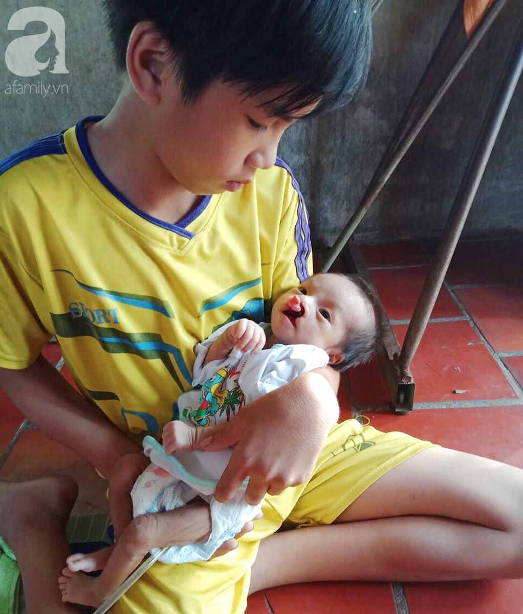 Xót cảnh bé trai 2 tháng tuổi bị suy dinh dưỡng, nặng chỉ 2 ký mà mẹ nghèo không đủ tiền để đưa lên Sài Gòn chữa bệnh 11