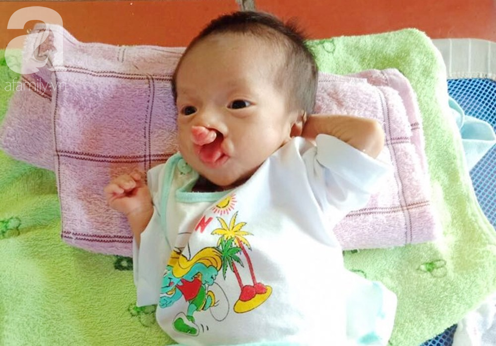 Xót cảnh bé trai 2 tháng tuổi bị suy dinh dưỡng, nặng chỉ 2 ký mà mẹ nghèo không đủ tiền để đưa lên Sài Gòn chữa bệnh 5