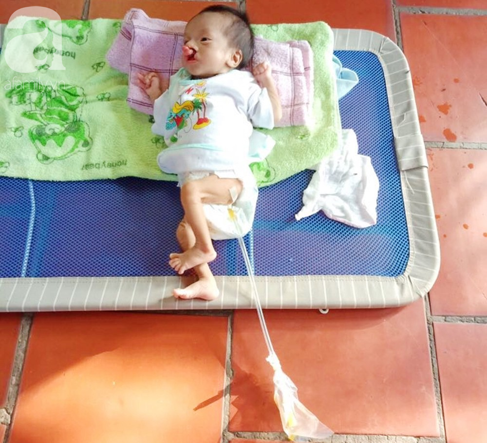 Xót cảnh bé trai 2 tháng tuổi bị suy dinh dưỡng, nặng chỉ 2 ký mà mẹ nghèo không đủ tiền để đưa lên Sài Gòn chữa bệnh - Ảnh 10.