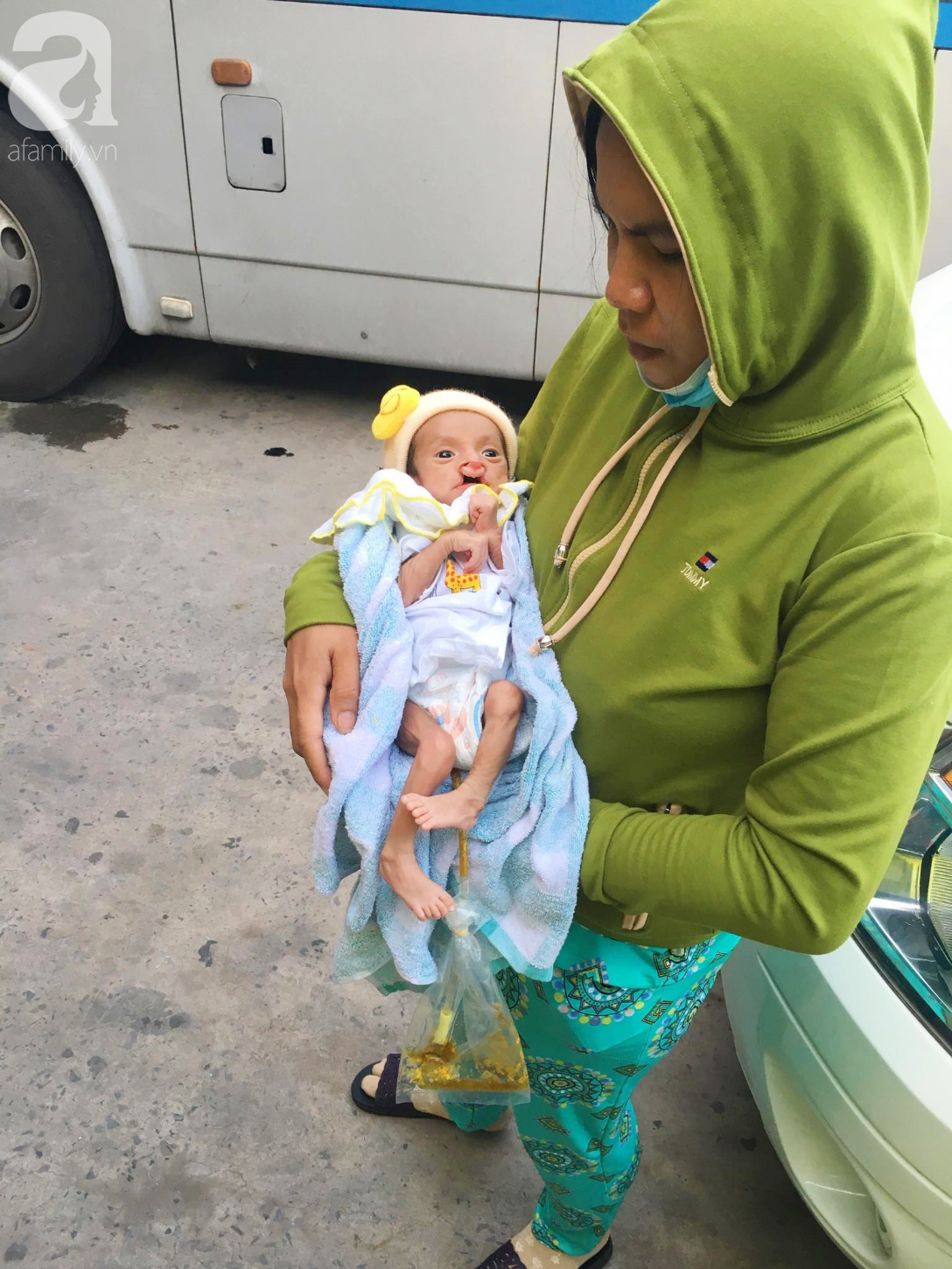 Xót cảnh bé trai 2 tháng tuổi bị suy dinh dưỡng, nặng chỉ 2 ký mà mẹ nghèo không đủ tiền để đưa lên Sài Gòn chữa bệnh 4