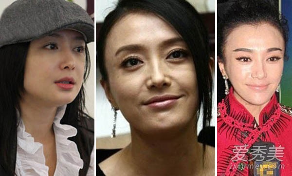 Ho&agrave;ng hậu nh&acirc;n từ trong Di&ecirc;n Hi C&ocirc;ng Lược vướng nhiều nghi &aacute;n thẩm mỹ để c&oacute; được nhan sắc đẹp lộng lẫy ở tuổi 37 - Ảnh 12.