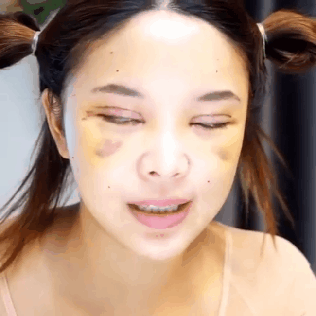 Hot girl Th&aacute;i c&ocirc;ng khai loạt h&igrave;nh thẩm mỹ sau 20 ng&agrave;y c&ugrave;ng hội bạn th&acirc;n khiến nhiều người bất ngờ  - Ảnh 10.