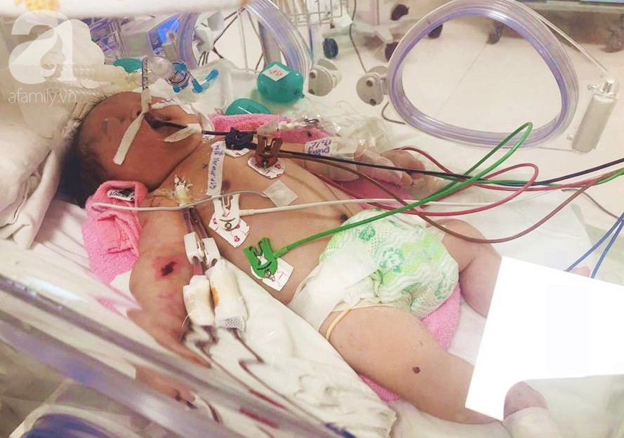 TP.HCM: B&eacute; trai 5 ng&agrave;y tuổi đang khỏe mạnh bỗng ọc m&aacute;u, suy h&ocirc; hấp v&agrave; h&ocirc;n m&ecirc; v&igrave; căn bệnh rất hiểm - Ảnh 1.