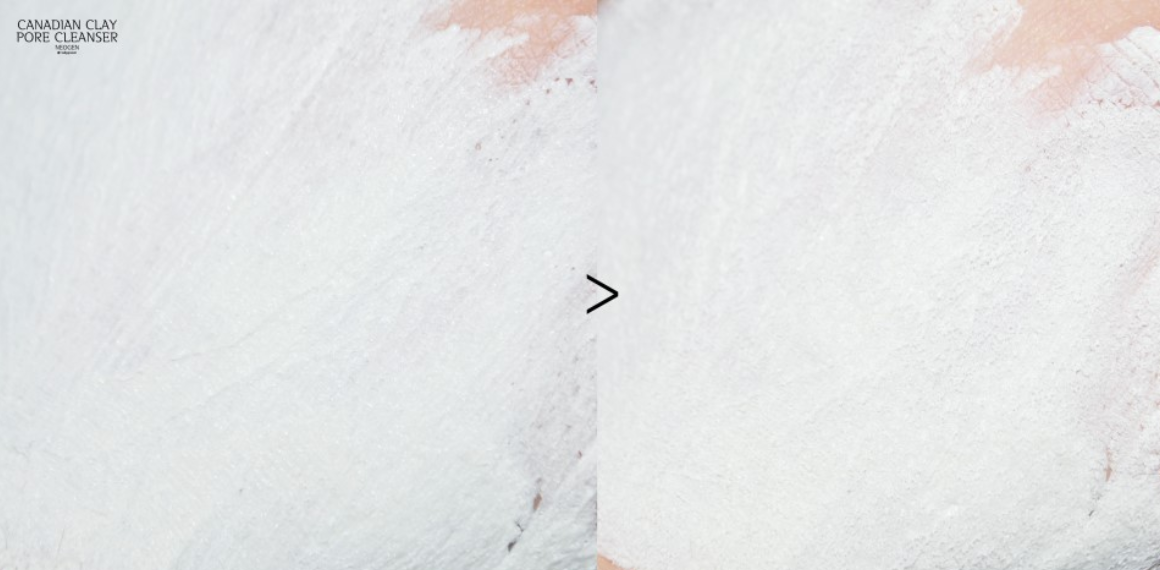 Hội con g&aacute;i H&agrave;n chỉ tin d&ugrave;ng 5 sản phẩm n&agrave;y để trị sạch đ&aacute;m mụn đầu đen xấu x&iacute; - Ảnh 13.