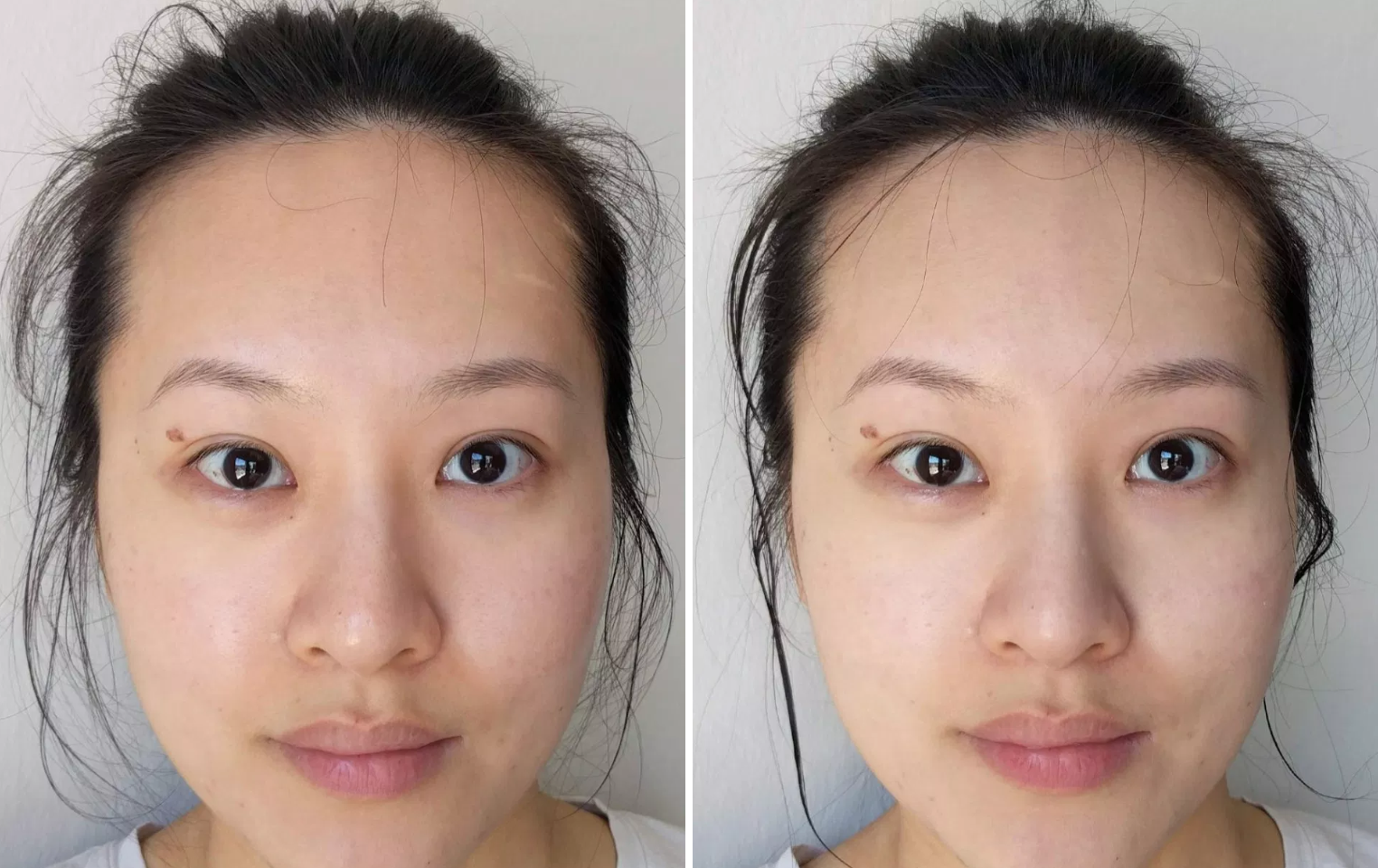 Hội con g&aacute;i H&agrave;n chỉ tin d&ugrave;ng 5 sản phẩm n&agrave;y để trị sạch đ&aacute;m mụn đầu đen xấu x&iacute; - Ảnh 14.