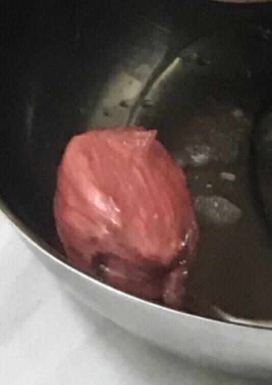 (CHUYỆN KH&Oacute; TIN) 12 giờ giải cứu cục ma t&uacute;y giấu trong v&ugrave;ng k&iacute;n - Ảnh 1.