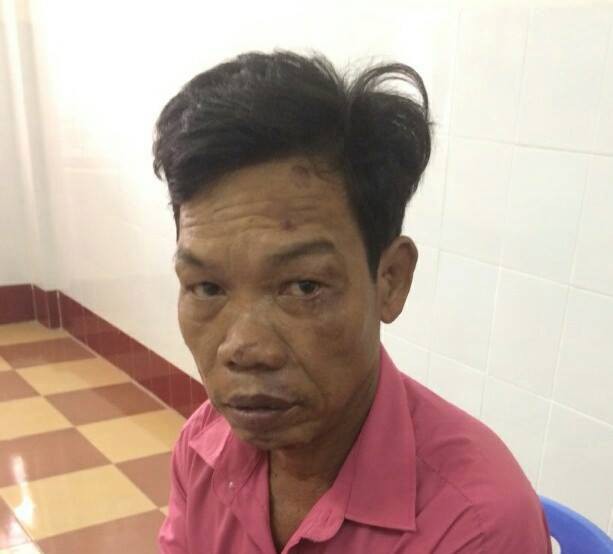 B&igrave;nh Định: Bị mắng trong l&uacute;c nhậu nhẹt, con trai đ&aacute;nh chết cha gi&agrave; 84 tuổi, đe dọa mọi người kh&ocirc;ng được đưa đi cấp cứu - Ảnh 1.