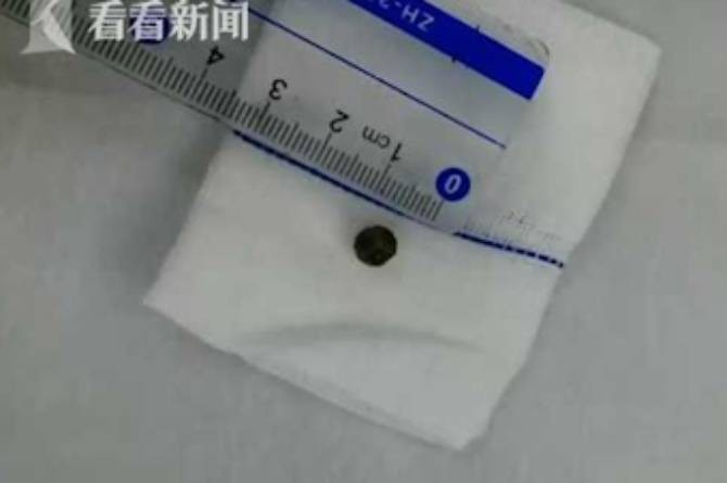 Cho con uống trà sữa trân châu, mẹ hoảng loạn khi con ho và sốt liên tục, nửa năm sau phát hiện sự thật kinh hoàng - Ảnh 3. Cho con uống trà sữa trân châu, mẹ hoảng loạn khi con ho và sốt liên tục, nửa năm sau phát hiện sự thật kinh hoàng - Ảnh 3.