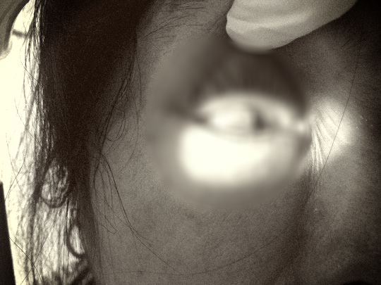 Vợ bị chồng đấm vỡ nh&atilde;n cầu - Ảnh 1.