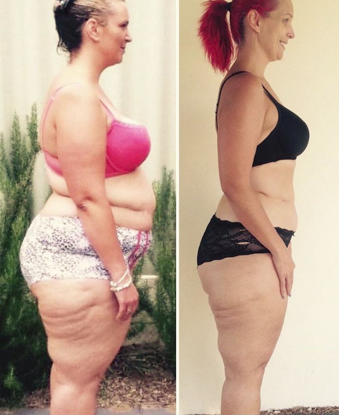 Bị dìm hàng trên Facebook đúng vào dịp sinh nhật con, bà mẹ 160kg đã quyết tâm thay đổi và giảm liền 70kg - Ảnh 5. Bị dìm hàng trên Facebook đúng vào dịp sinh nhật con, bà mẹ 160kg đã quyết tâm thay đổi và giảm liền 70kg - Ảnh 5.