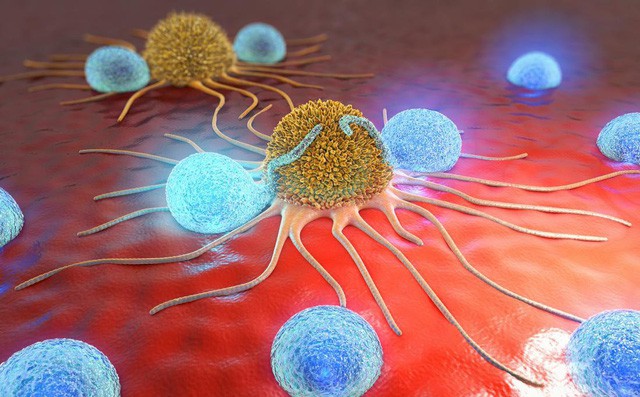 10 giải pháp "phong tỏa" tế bào ung thư: Nếu muốn phòng bệnh hiệu quả, hãy tham khảo ngay