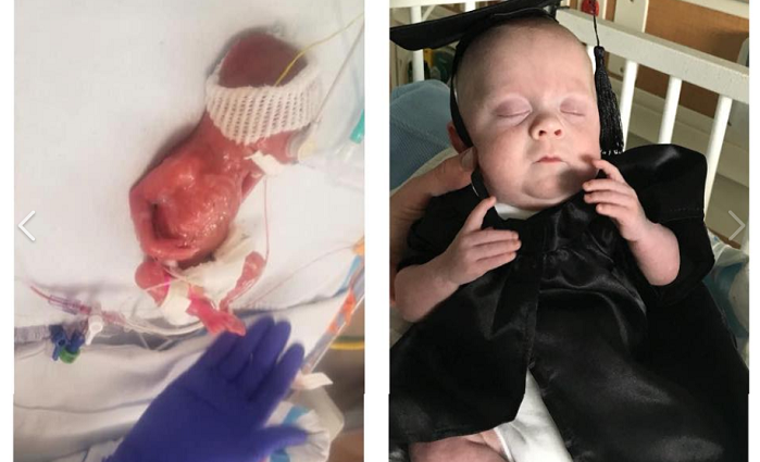 Kì diệu bé trai sinh non 22 tuần thai chỉ nặng 0,4kg đã sống sót và trở về trong vòng tay cha mẹ sau 160 ngày chăm sóc đặc biệt - Ảnh 2. Kì diệu bé trai sinh non 22 tuần thai chỉ nặng 0,4kg đã sống sót và trở về trong vòng tay cha mẹ sau 160 ngày chăm sóc đặc biệt - Ảnh 2.