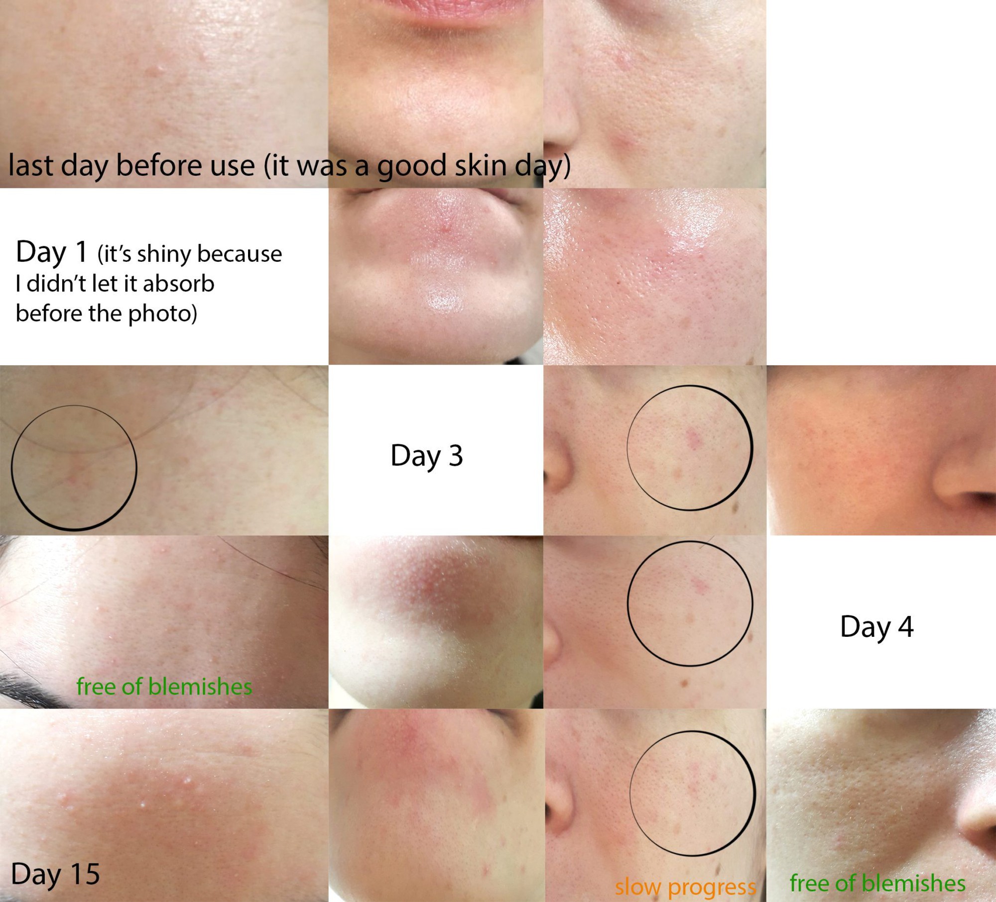 Không phải Collagen hay Vitamin E, loại Vitamin ít được quan tâm này mới giúp da bạn từ sần sùi thành căng mịn - Ảnh 7. Không phải Collagen hay Vitamin E, loại Vitamin ít được quan tâm này mới giúp da bạn từ sần sùi thành căng mịn - Ảnh 7.