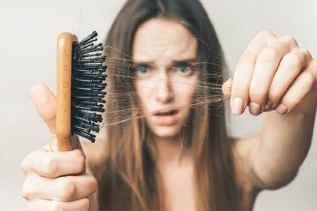 Thoát khỏi tình trạng vuốt tóc thôi cũng ra cả búi với 6 loại dầu gội ngăn rụng tóc được các chuyên gia đánh giá rất cao trên Amazon - Ảnh 1. Thoát khỏi tình trạng vuốt tóc thôi cũng ra cả búi với 6 loại dầu gội ngăn rụng tóc được các chuyên gia đánh giá rất cao trên Amazon - Ảnh 1.