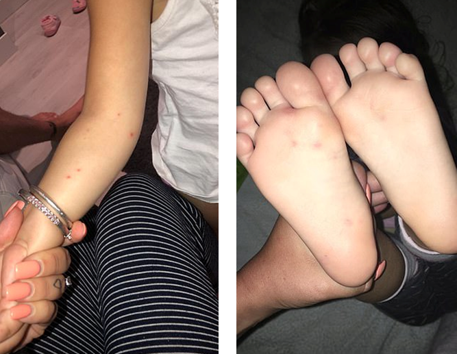 Cho con đi nghỉ dưỡng tại resort sang trọng, mẹ không ngờ lại rước bệnh tay chân miệng cho cả 2 con ở đây - Ảnh 4. Cho con đi nghỉ dưỡng tại resort sang trọng, mẹ không ngờ lại rước bệnh tay chân miệng cho cả 2 con ở đây - Ảnh 4.