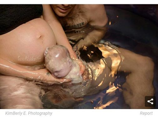 Những bức ảnh sinh nở cực hiếm khi em bé chào đời còn nguyên trong túi ối - Ảnh 3.
