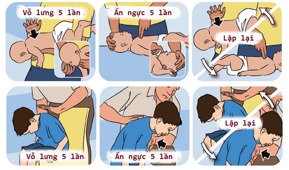 Vì món đồ chơi quen thuộc này, người mẹ chỉ biết đứng nhìn con hóc nghẹn Con tôi sắp chết! - Ảnh 4. Vì món đồ chơi quen thuộc này, người mẹ chỉ biết đứng nhìn con hóc nghẹn Con tôi sắp chết! - Ảnh 4.