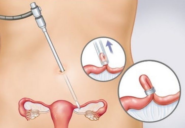 Thừa cân, béo phì cũng có thể dẫn đến 8 loại bệnh ung thư nguy hiểm mà bạn không nên xem thường - Ảnh 1. Thừa cân, béo phì cũng có thể dẫn đến 8 loại bệnh ung thư nguy hiểm mà bạn không nên xem thường - Ảnh 1.