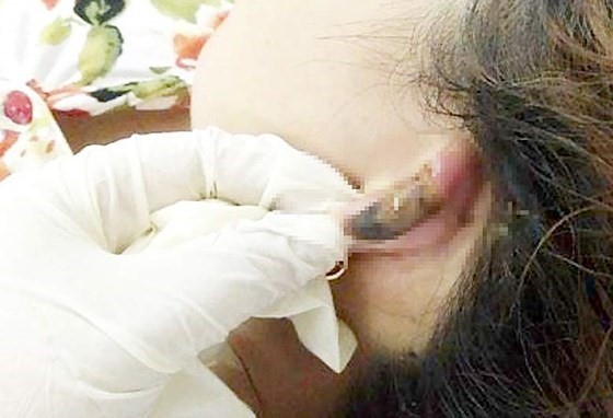Làm đẹp đón Tết, tan nát nhan sắc - Ảnh 2. Làm đẹp đón Tết, tan nát nhan sắc - Ảnh 2.