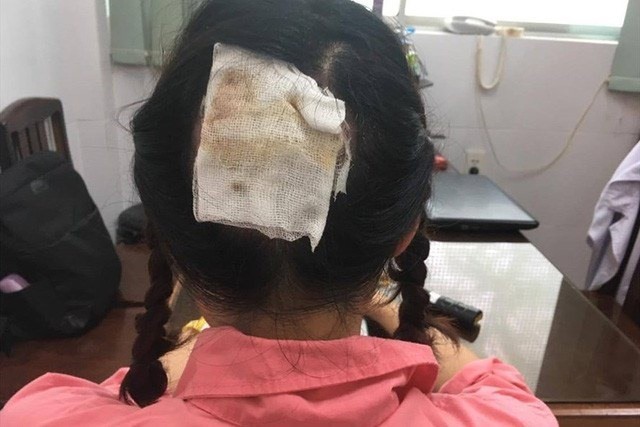 Làm đẹp đón Tết, tan nát nhan sắc - Ảnh 3. Làm đẹp đón Tết, tan nát nhan sắc - Ảnh 3.