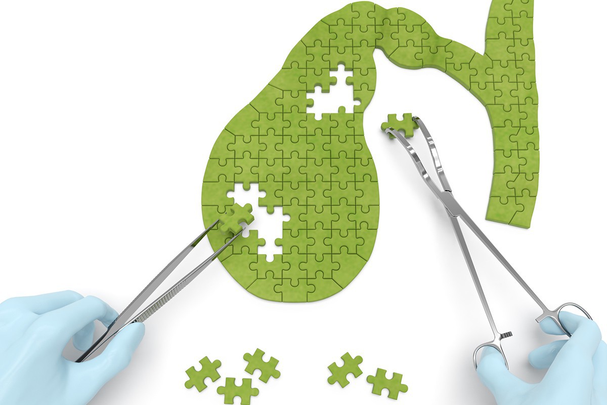 Thừa cân, béo phì cũng có thể dẫn đến 8 loại bệnh ung thư nguy hiểm mà bạn không nên xem thường - Ảnh 7. Thừa cân, béo phì cũng có thể dẫn đến 8 loại bệnh ung thư nguy hiểm mà bạn không nên xem thường - Ảnh 7.