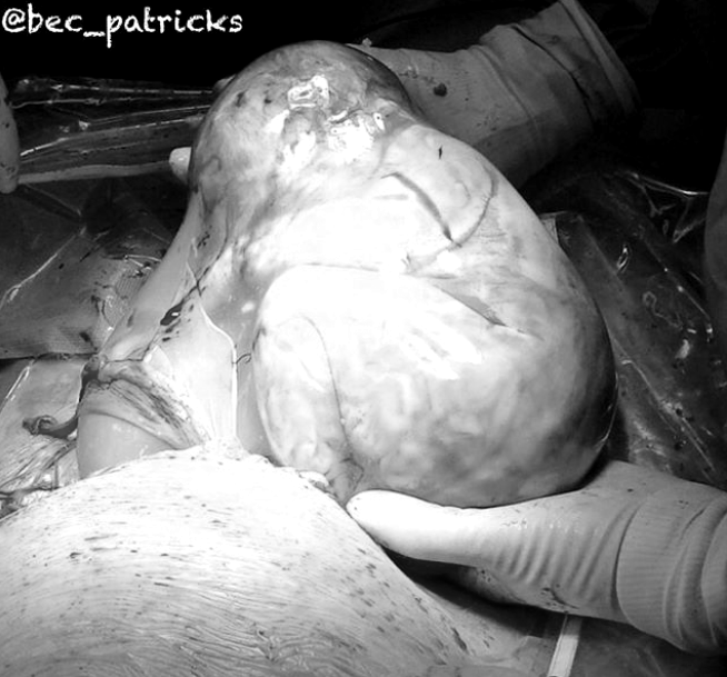 Những bức ảnh sinh nở cực hiếm khi em bé chào đời còn nguyên trong túi ối - Ảnh 12.