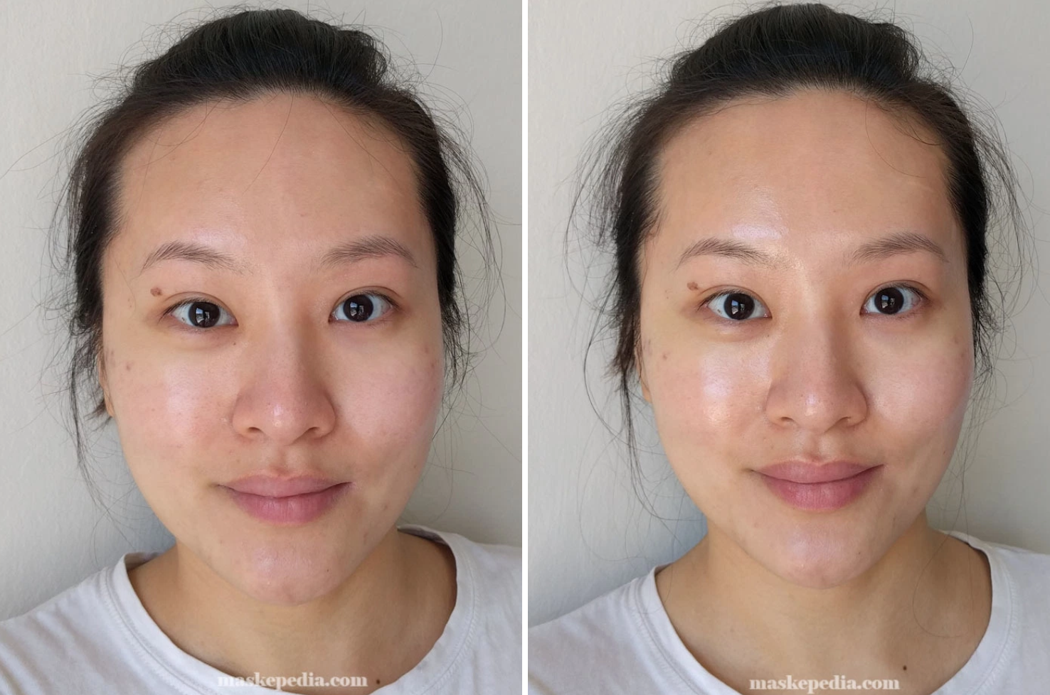 Mụn giảm sưng và cồi mụn được đẩy lên nhanh hơn nhờ 10 loại mặt nạ giấy này - Ảnh 4. Mụn giảm sưng và cồi mụn được đẩy lên nhanh hơn nhờ 10 loại mặt nạ giấy này - Ảnh 4.