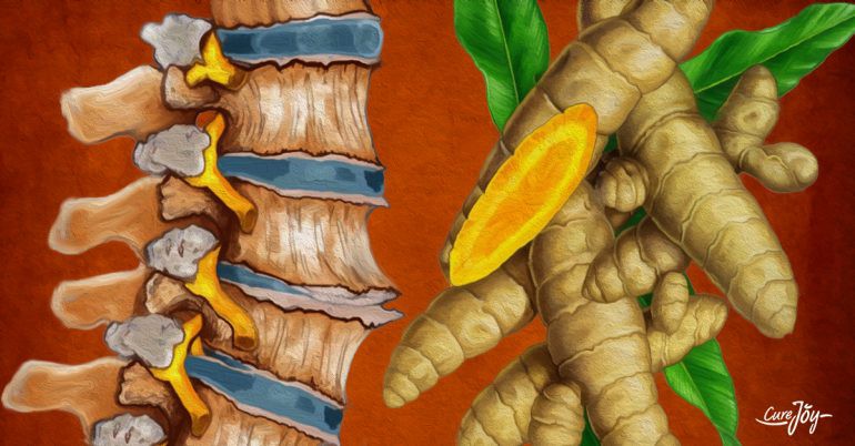 Dắt túi những mẹo hay này, bạn hoàn toàn có thể kiểm soát được thoái hóa đĩa đệm ngay tại nhà - Ảnh 1. Dắt túi những mẹo hay này, bạn hoàn toàn có thể kiểm soát được thoái hóa đĩa đệm ngay tại nhà - Ảnh 1.