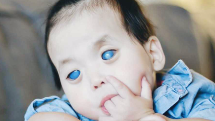 Bé gái với đôi mắt kỳ lạ xanh thăm thẳm như đại dương nhưng lại ẩn chứa một sự thật đau lòng đằng sau - Ảnh 1. Bé gái với đôi mắt kỳ lạ xanh thăm thẳm như đại dương nhưng lại ẩn chứa một sự thật đau lòng đằng sau - Ảnh 1.