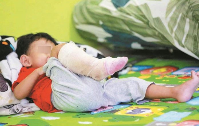 Con bị nhiễm vi khuẩn ăn thịt người, mẹ hối hận tột độ vì đã phớt lờ điều tưởng chừng như vô hại này - Ảnh 2. Con bị nhiễm vi khuẩn ăn thịt người, mẹ hối hận tột độ vì đã phớt lờ điều tưởng chừng như vô hại này - Ảnh 2.