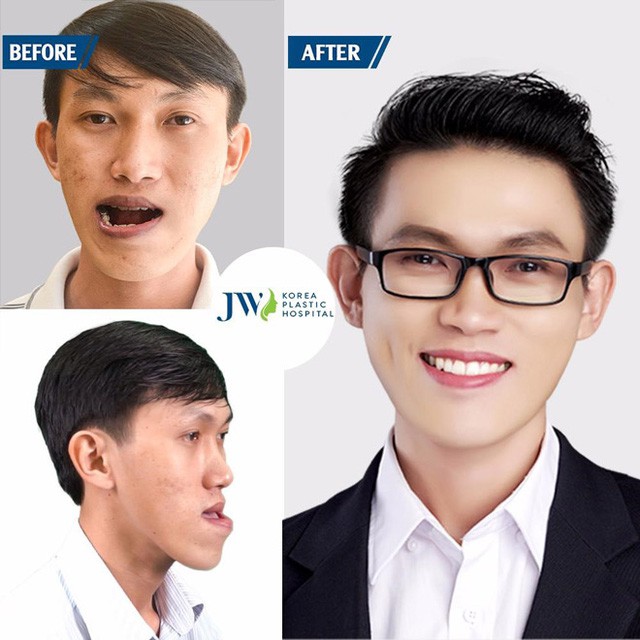 Mừng xuân Kỷ Hợi-JW tặng 5 suất làm đẹp miễn phí mỗi ngày - Ảnh 4. Mừng xuân Kỷ Hợi-JW tặng 5 suất làm đẹp miễn phí mỗi ngày - Ảnh 4.