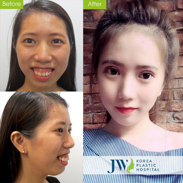 Mừng xuân Kỷ Hợi-JW tặng 5 suất làm đẹp miễn phí mỗi ngày - Ảnh 5. Mừng xuân Kỷ Hợi-JW tặng 5 suất làm đẹp miễn phí mỗi ngày - Ảnh 5.