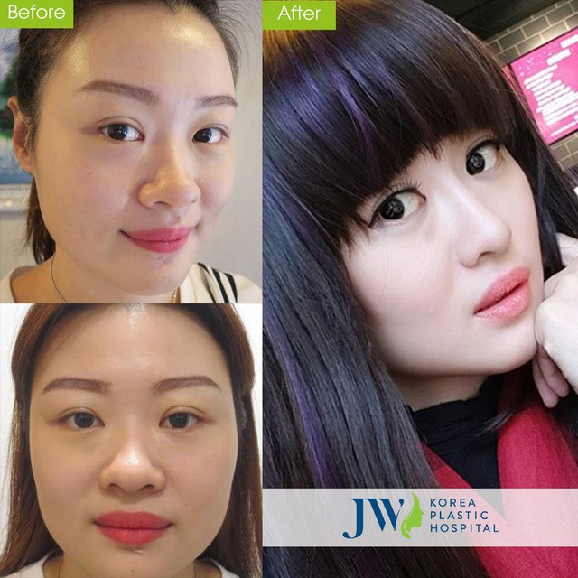 Mừng xuân Kỷ Hợi-JW tặng 5 suất làm đẹp miễn phí mỗi ngày - Ảnh 6. Mừng xuân Kỷ Hợi-JW tặng 5 suất làm đẹp miễn phí mỗi ngày - Ảnh 6.