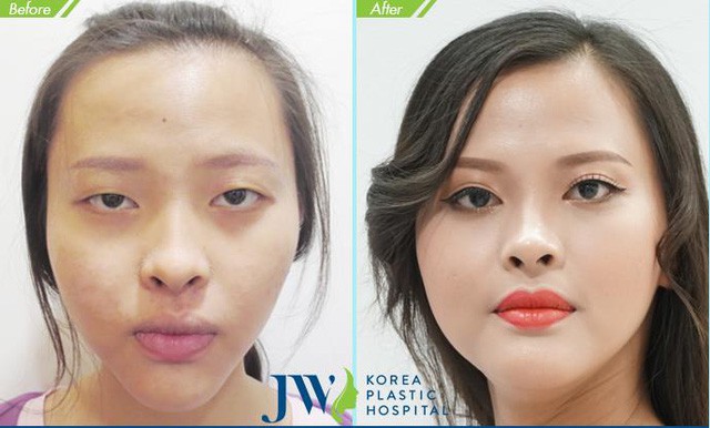 Mừng xuân Kỷ Hợi-JW tặng 5 suất làm đẹp miễn phí mỗi ngày - Ảnh 7. Mừng xuân Kỷ Hợi-JW tặng 5 suất làm đẹp miễn phí mỗi ngày - Ảnh 7.