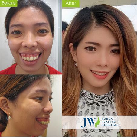 Mừng xuân Kỷ Hợi-JW tặng 5 suất làm đẹp miễn phí mỗi ngày - Ảnh 8. Mừng xuân Kỷ Hợi-JW tặng 5 suất làm đẹp miễn phí mỗi ngày - Ảnh 8.