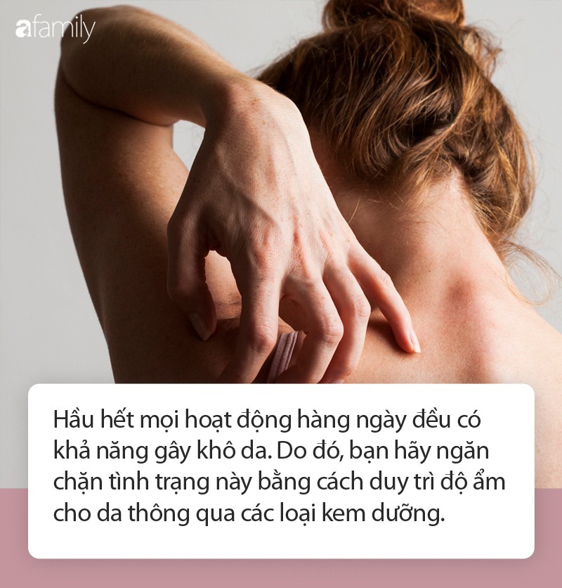 Nguyên nhân gây ngứa da và cách ngăn ngừa tình trạng này - Ảnh 1. Nguyên nhân gây ngứa da và cách ngăn ngừa tình trạng này - Ảnh 1.